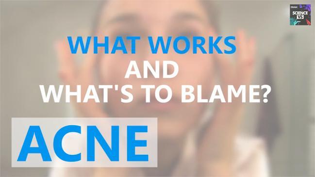 Acne: What works and what's to blame