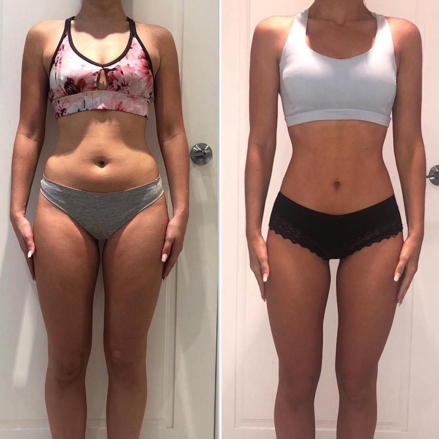 Zara Spooner, 22, lost 18kg through flexible dieting. Picture: Zara Spooner