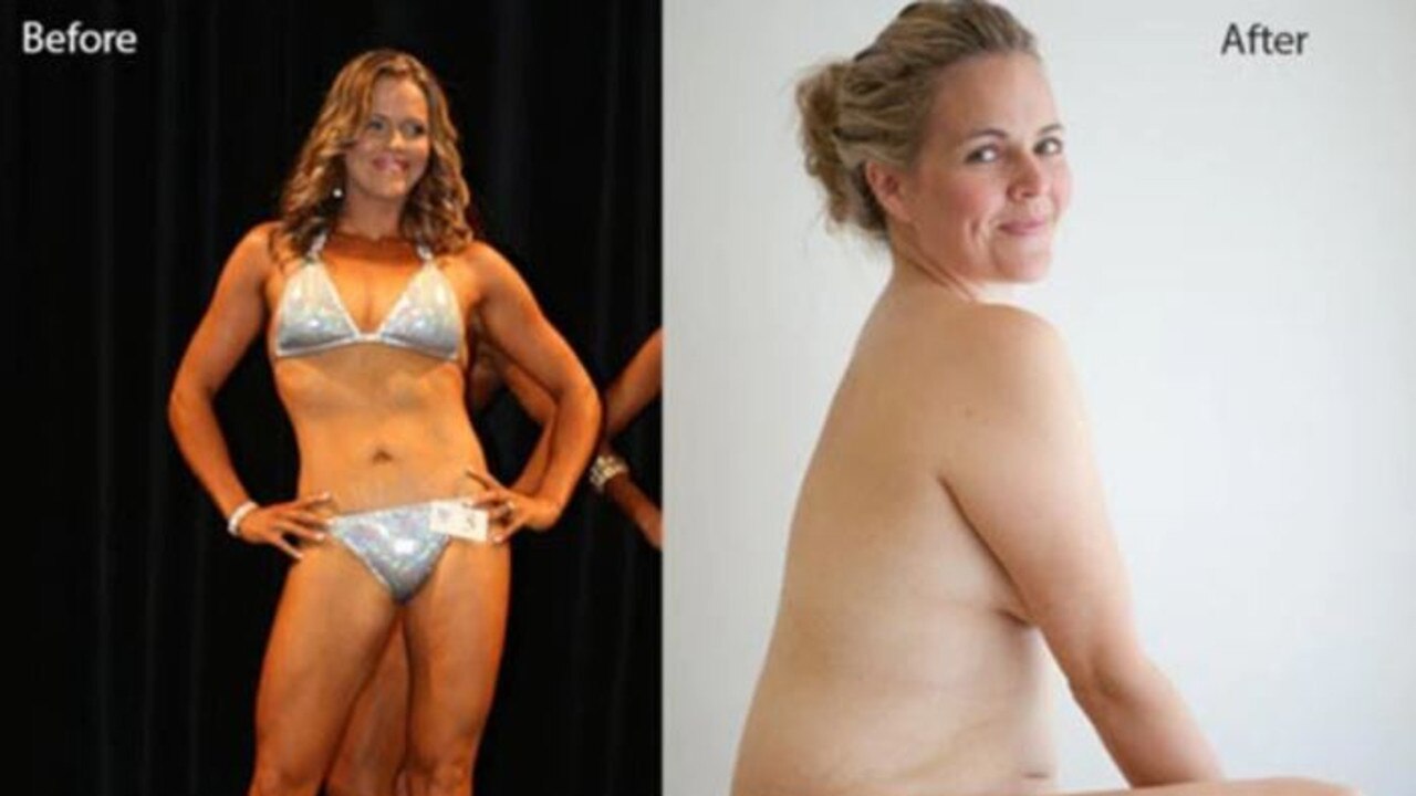 Taryn Brumfitt’s ‘before and after’ went viral.