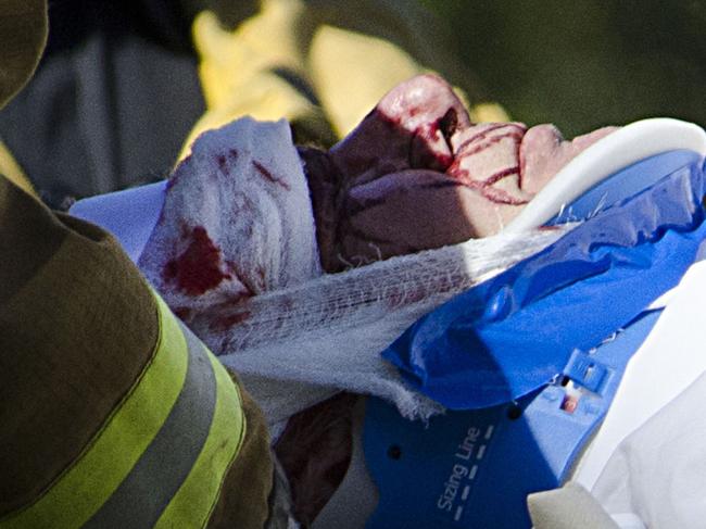 MUST CREDIT SNAPPER MEDIA GROUP RIGHTS ALL PLATFORMS Exclusive 51671152 Star Wars actor Harrison Ford is seen getting worked on by paramedics after crashing his 1930 s Vintage plane on the Penmar golf course in Venice California on March 5 2015 Paramedics quickly wrapped up the actor s head which had numerous cuts and was bleeding pretty bad before wisking him away to the UCLA medical center FameFlynet Inc Beverly Hills CA USA 1 818 307 4813