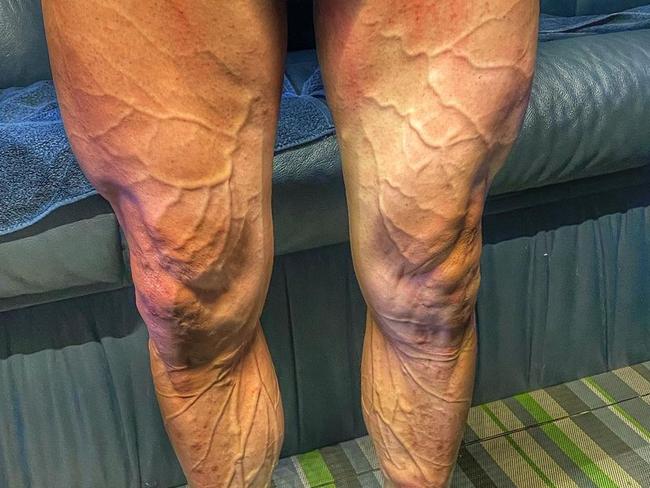 Jose Joaquin Rojas shows off his insane legs