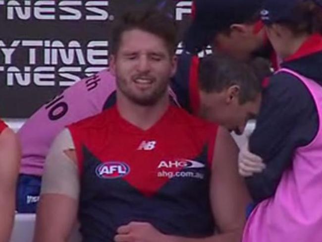 Jesse Hogan cradles a broken collar bone on the bench against North Melbourne in Hobart.