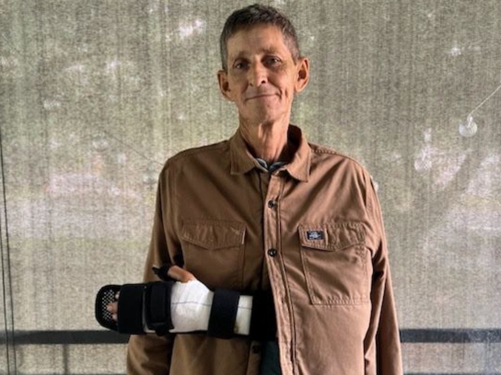 Allan Kerr almost lost his arm during a violent home invasion in northern NSW. Picture: Supplied