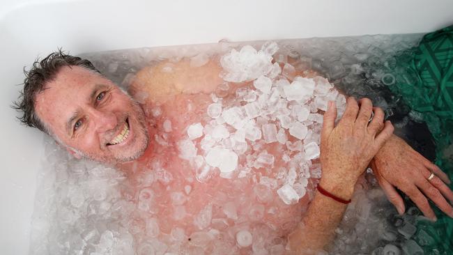 Experts recommend an ice bath. (AAPImage/Sue Graham)