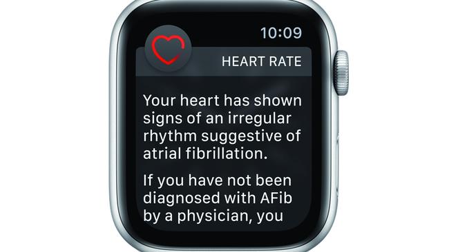 Apple Watch atrial fibrillation notification