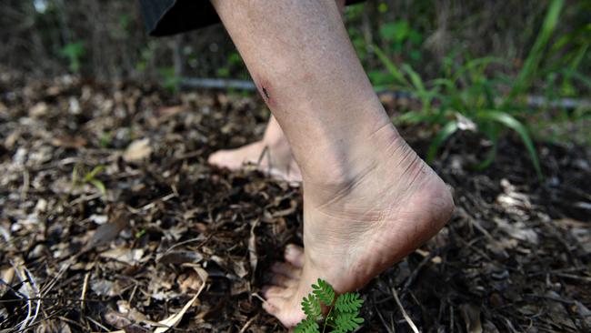 Soil-borne melioidosis is potentially fatal.