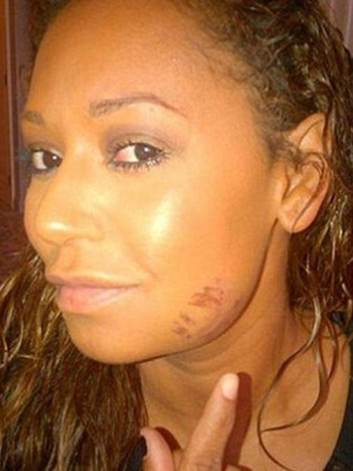 The former Spice Girl has accused husband Stephen Belafonte of beating her.