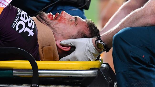 Corey Oates of the Broncos is treated by medical staff after being injured during the NRL Semi-Final match between the Brisbane Broncos and the Penrith Panthers at Suncorp Stadium in Brisbane, Friday, September 15, 2017. (AAP Image/Darren England) NO ARCHIVING