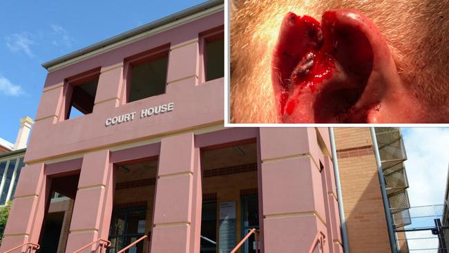 The trial off an alleged pub assault which resulted in a partially severed ear for one off-duty cop has hit day three.