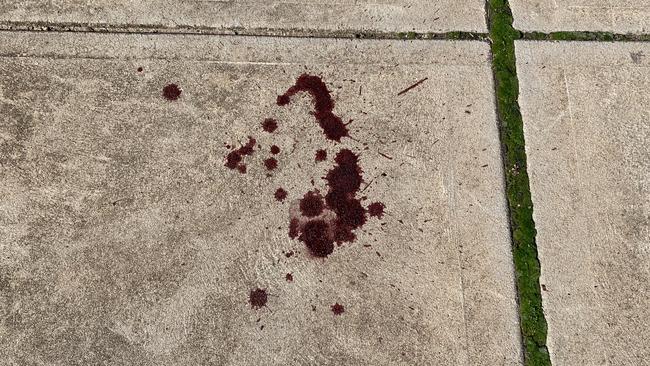 Blood stains on the Esplanade from the stabbing at Semaphore last night. Picture: Paula Thompson