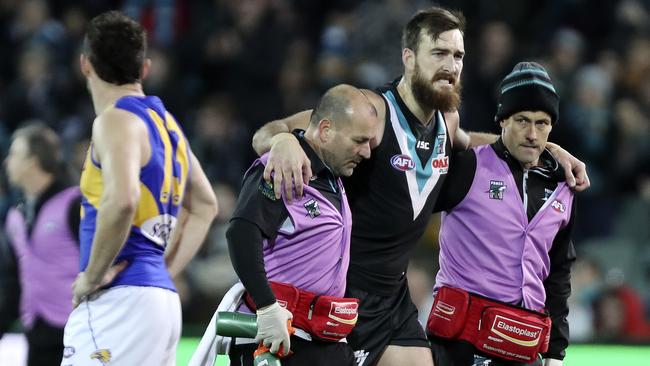 Port Adelaide key forward Charlie Dixon has a broken leg that has ended his AFL season. Picture: Sarah Reed