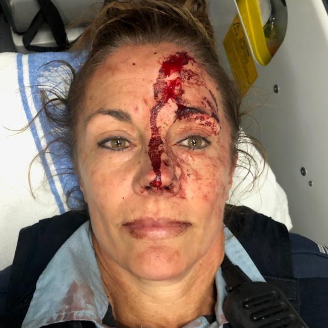 NSW Police issued a photo of the injured female officer following the incident. Picture: NSW Police