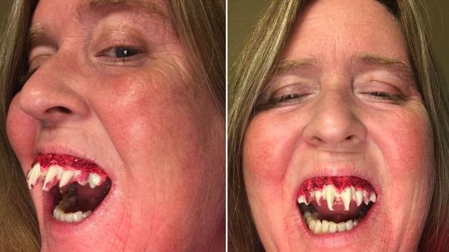 Dentists warn against these vampire fangs Halloween hacks on TikTok - ABC  News