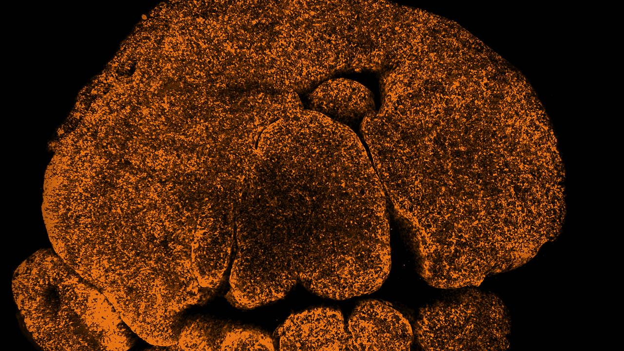 It looks like a Halloween pumpkin, but this collection of dots show the cells forming part of the thymus. Picture: WEHI