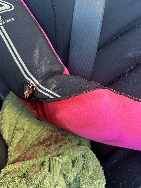 Pam Bennett, 68, was left with an Eagle Ray barb stuck in her arm after it pierced her wetsuit on the Yorke Peninsula.