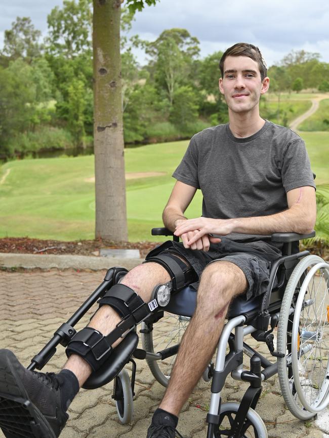 Peter McAulay was mowed down and seriously injured by a teenager driving a stolen car in Ipswich, 2018.