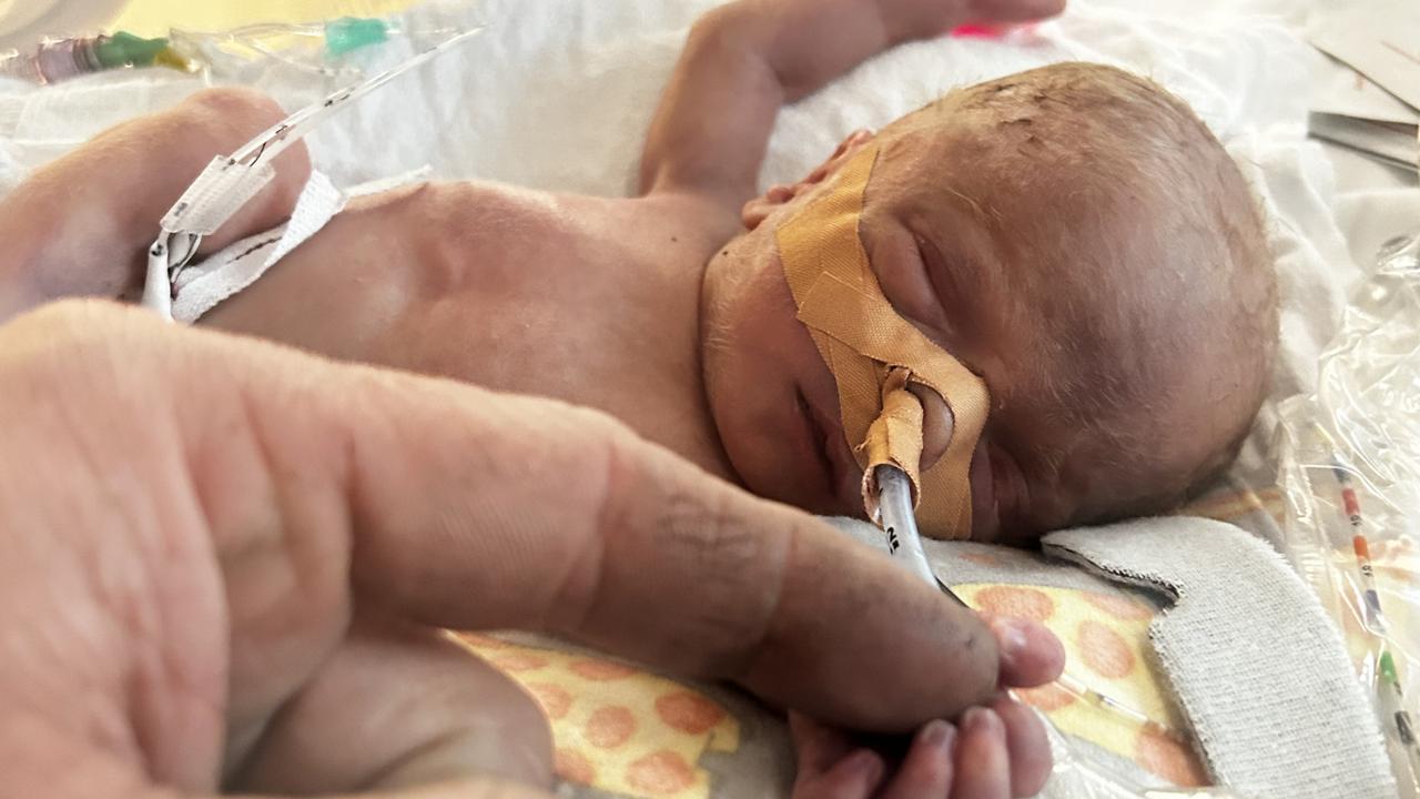 Baby born best sale 10 weeks early