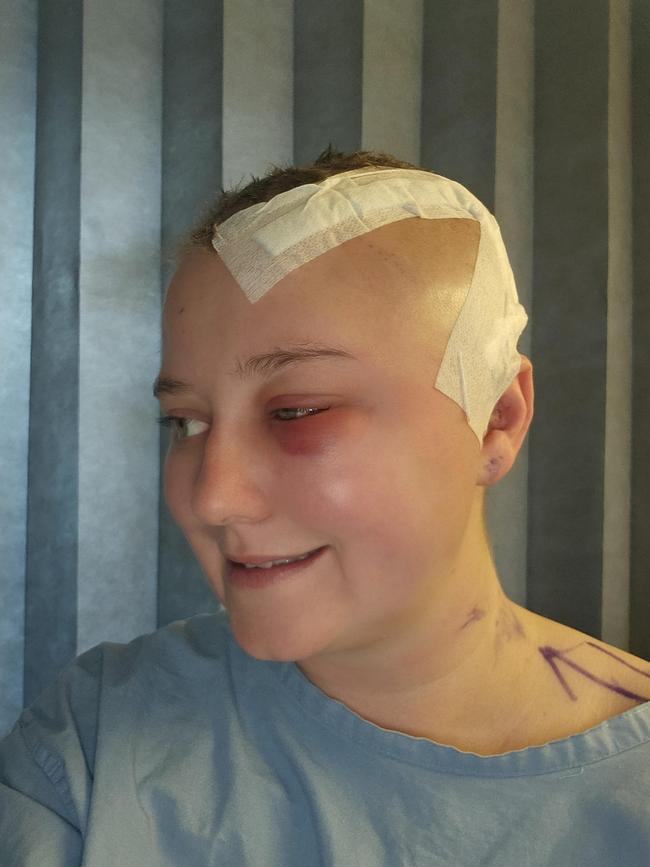 Saffron will need to continue to have radiotherapy and chemotherapy to ensure the rest of the tumour is destroyed. Picture: Supplied