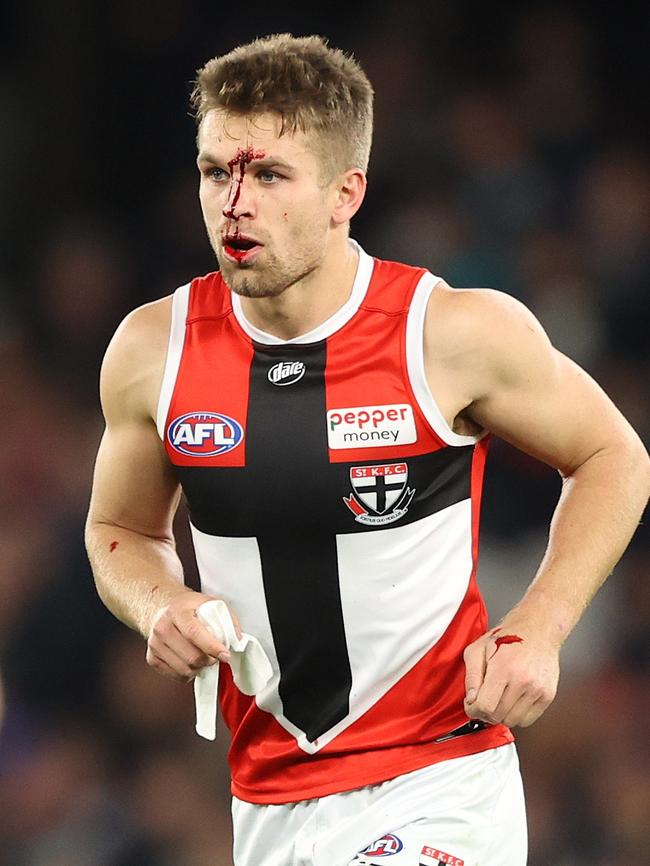 Dan Butler was left bloodied in the collision with Clark. Picture: Getty Images