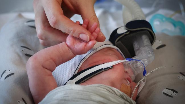 Baby George Ford weight just 699g when he was born at 24 weeks. Picture: David Caird