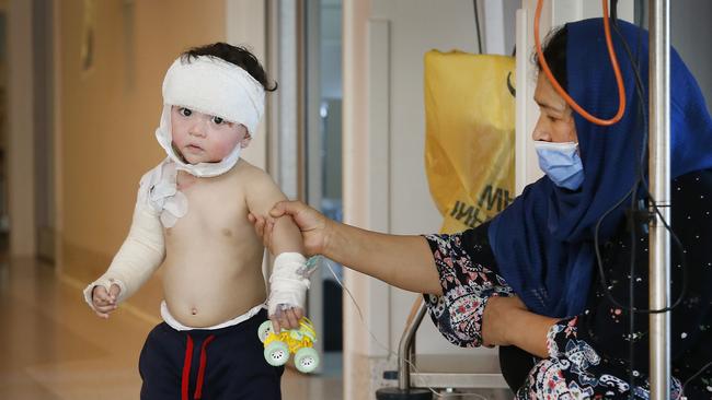 Burns victim Ryan Haidari 1, takes a few steps out of his room with his mum by his side. Picture: David Caird