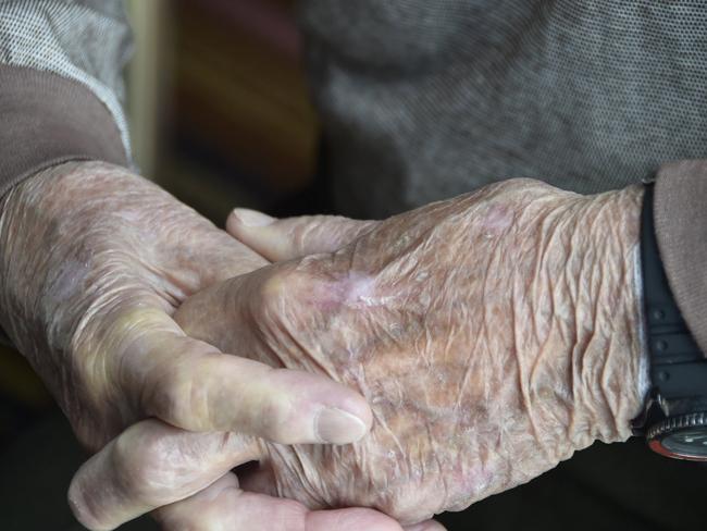 ONE STEP AHEAD: A Stepping On program, aimed at elderly fall prevention, is being held in Alstonville starting next month.