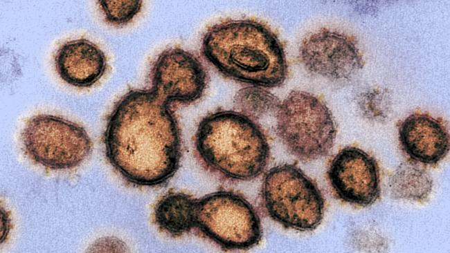 The COVID-19 virus. Picture: AFP