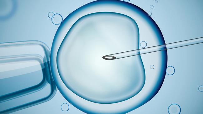 A digital illustration showing laboratory microscopic research of IVF. Picture: iStock.