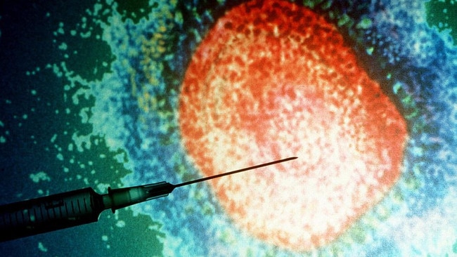 A person who is infected with measles has been to a number of South Brisbane locations. Picture: Getty