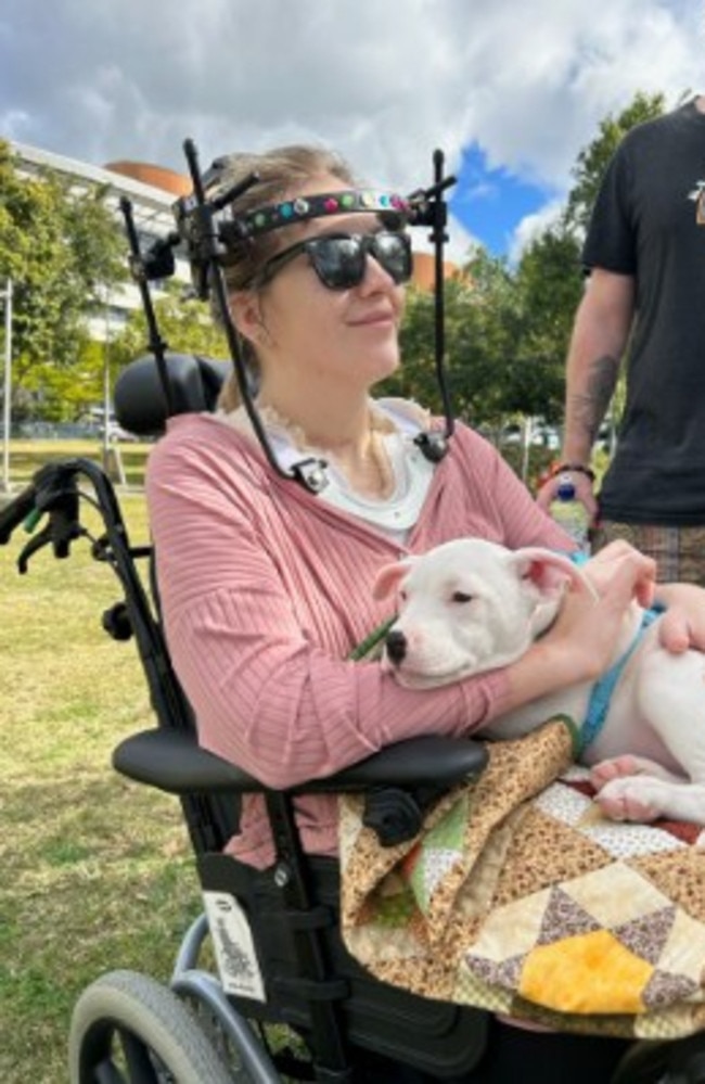 Stacie Chanoff with her halo brace on while undergoing treatment