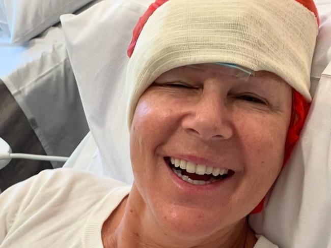 Julia Morris has had a skin cancer removed. Picture: Instagram