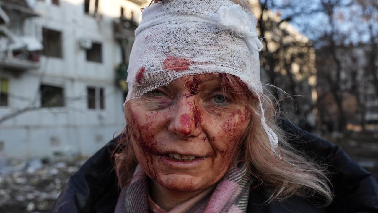 An injured woman pictured after the air strike in Kharkiv. Picture: Wolfgang Schwan/Anadolu Agency via Getty Images