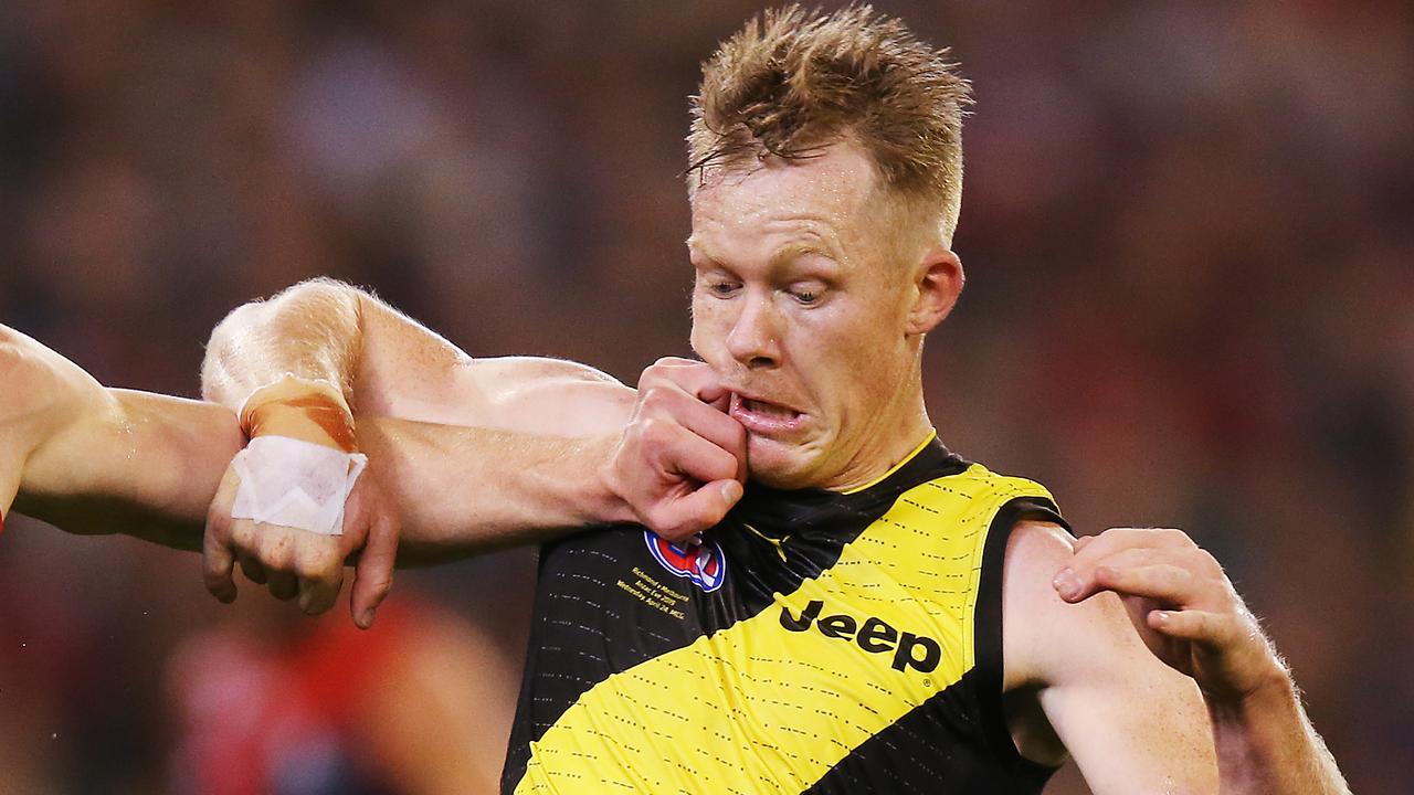 Jack Riewoldt is facing another stint on the sidelines. (Photo by Michael Dodge/Getty Images)