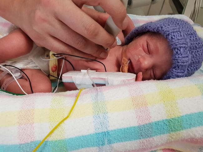 Agamveer Singh is lucky to be alive after being born without an oesophagus or an anal hole. Picture: Amandeep Singh