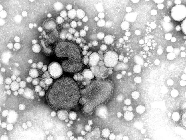 Image of H5N1 viruses Avian influenza. Bird flu. Virus.