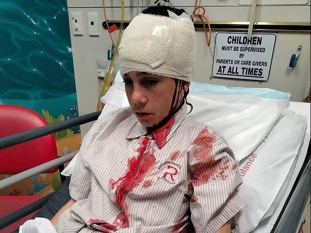 Boston Yarran was ambushed by a group of bullies on his way home from school. Picture: Facebook