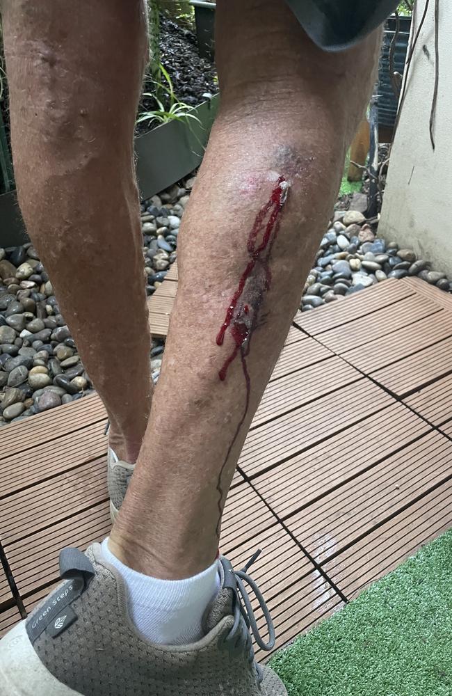 Brian Condran's injured leg. Picture: Supplied