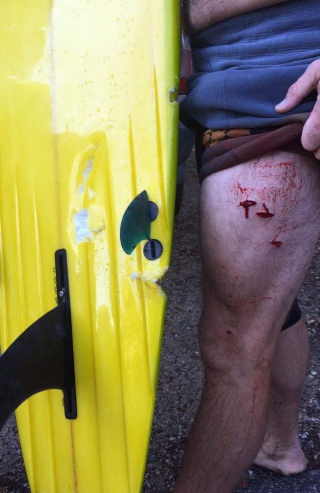 A surfer was attacked by a shark at Broken Head near Byron Bay this morning. Picture: Geoffrey John Knapp