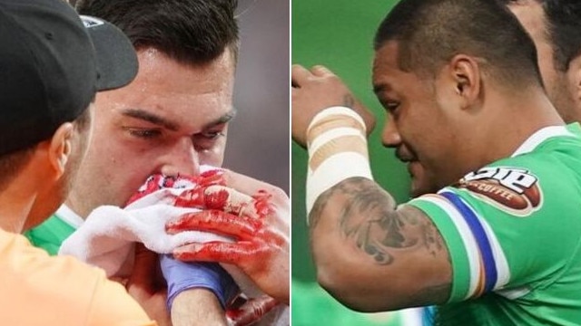 Nick Cotric copped a sickening nose injury while Joey Leilua picked up a freak eye injury.