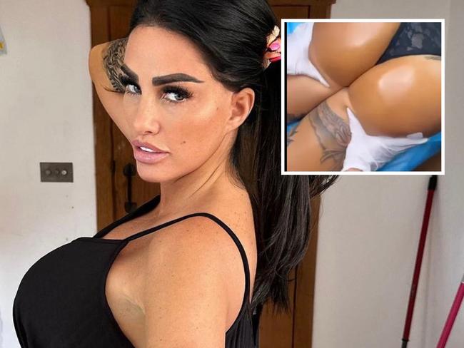 Katie Price streamed her recent bum lift live on TikTok.