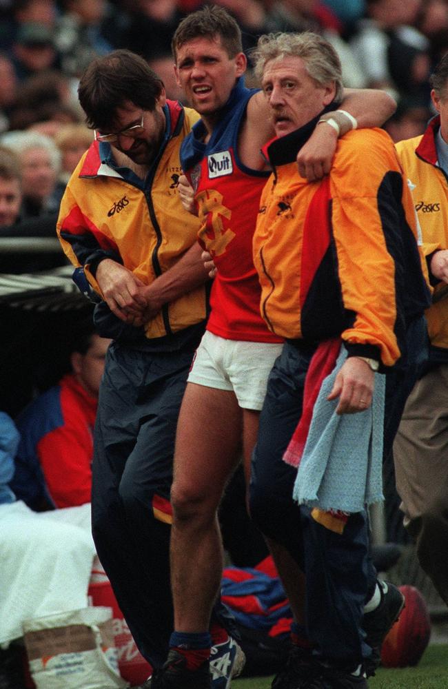 Trent Cummings injures his knee for the first time – in late 1996 playing for Fitzroy.