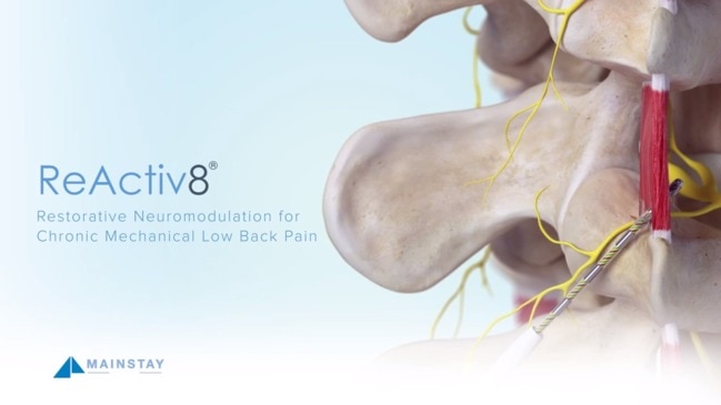 ReActiv8 – Restorative Nerve Stimulation for Back Pain