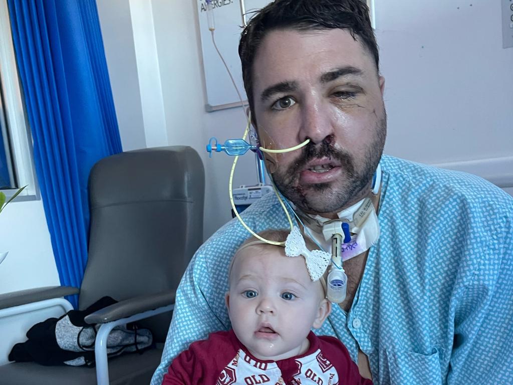 Shannon Pacher with his daughter Ellie at Townsville University Hospital after the head-on collision at Hay Point on June 5. Picture: Contributed