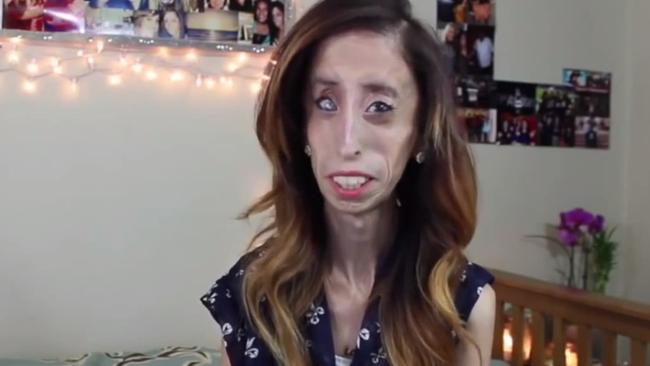 ‘world S Ugliest Woman Faces Up To Online Bullies In Anti Bullying