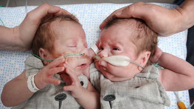 Mums Hannah and Lani touch the heads of their twin boys, Alfie and Otis, who were born at 24 weeks. Picture: David Caird