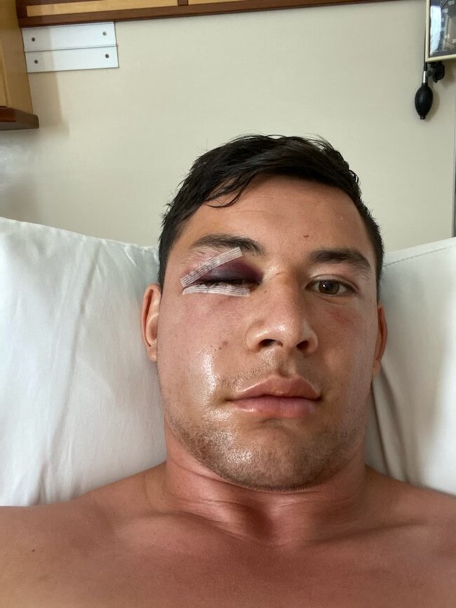 Joey Manu after surgery. Picture: supplied