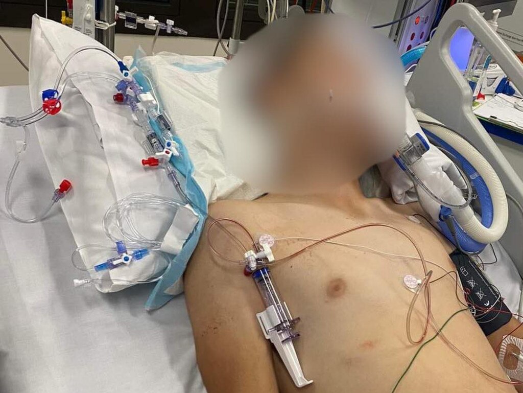 A teenage boy, fighting for life in hospital after an alleged attack at a Maryborough skatepark, was turning his life around after being involved in a vandalism incident.