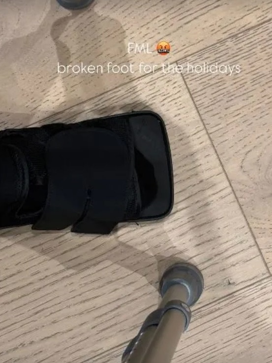 Kardashian shared a picture of her horror injury on Instagram. Picture: Instagram.