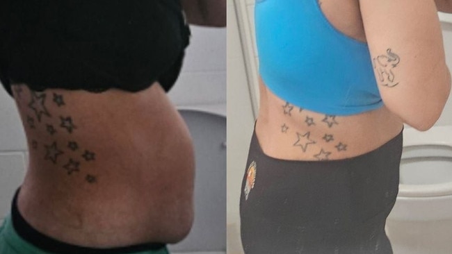 The left image shows Sam's 3kg tumour protruding from her stomach, while the right photo reveals her appearance after its removal. Picture: Supplied