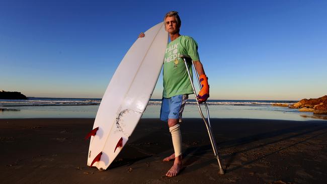 Evans Head shark attack victim Craig Ison back at the beach in Evans Head one month after being attacked by a shark. Pic Nathan Edwards